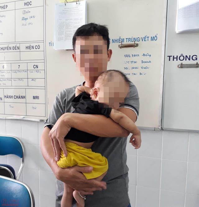 Phẫu thuật thành công cho 2 bệnh nhi bị dính khớp sọ kèm não úng thủy ảnh 1