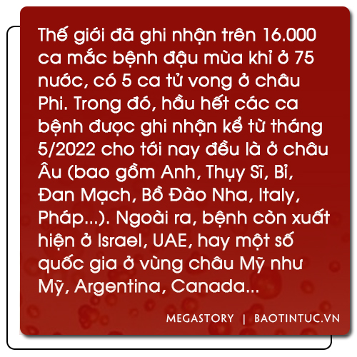 Cảnh giác với bệnh đậu mùa khỉ ảnh 4