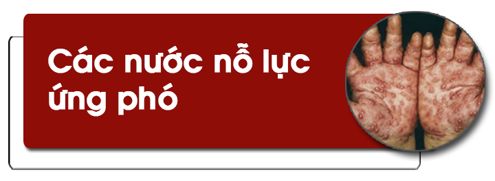 Cảnh giác với bệnh đậu mùa khỉ ảnh 6