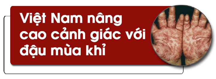Cảnh giác với bệnh đậu mùa khỉ ảnh 13