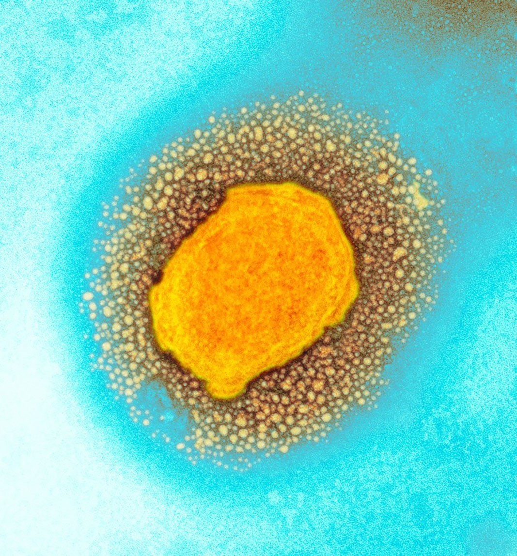 Hình ảnh virus đậu mùa khỉ dưới kính hiển vi điện tử.
