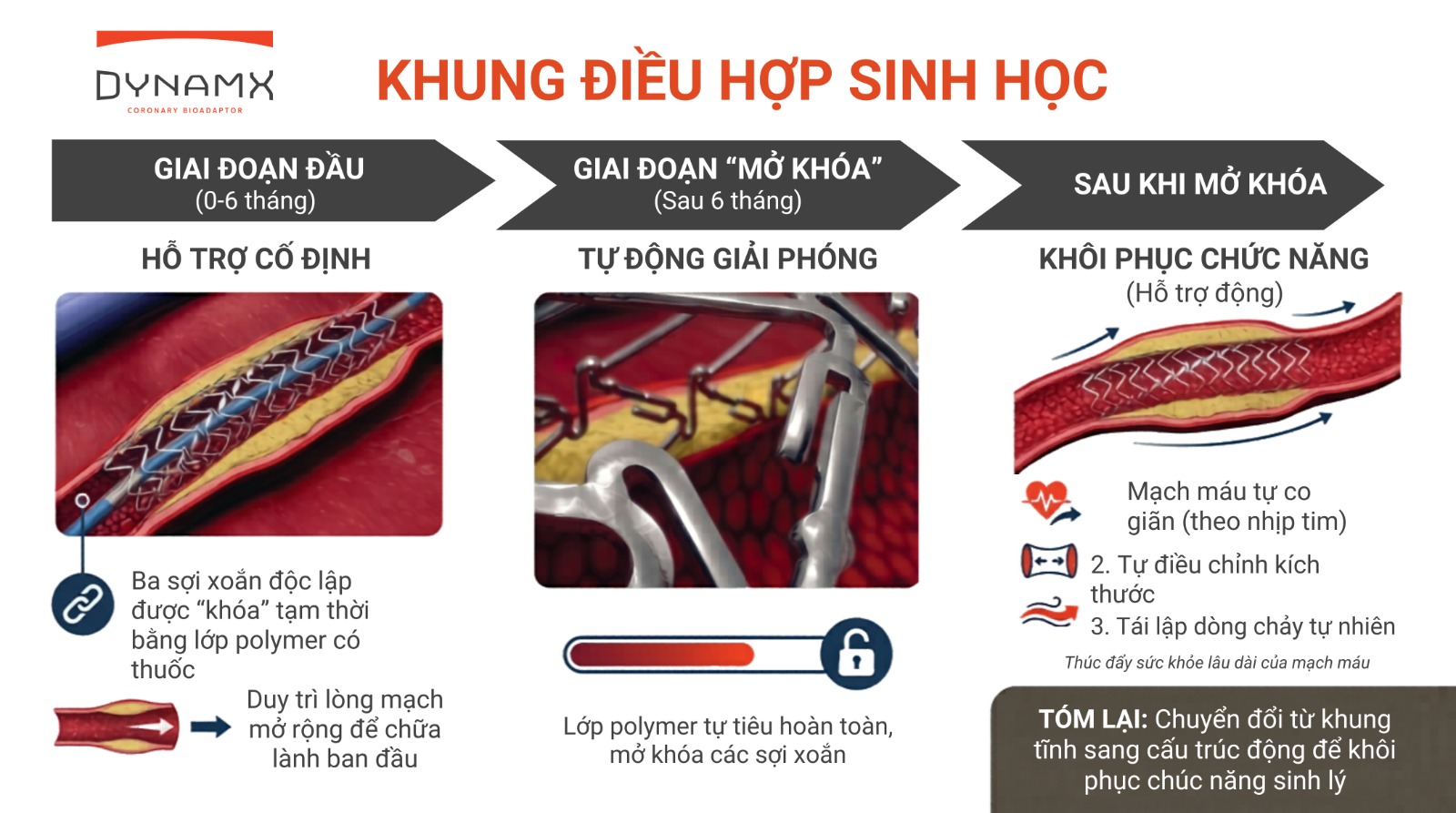 Khung điều hợp sinh học chứng minh giảm vượt trội tỷ lệ biến cố tim mạch sau 4 năm so với stent phủ thuốc
